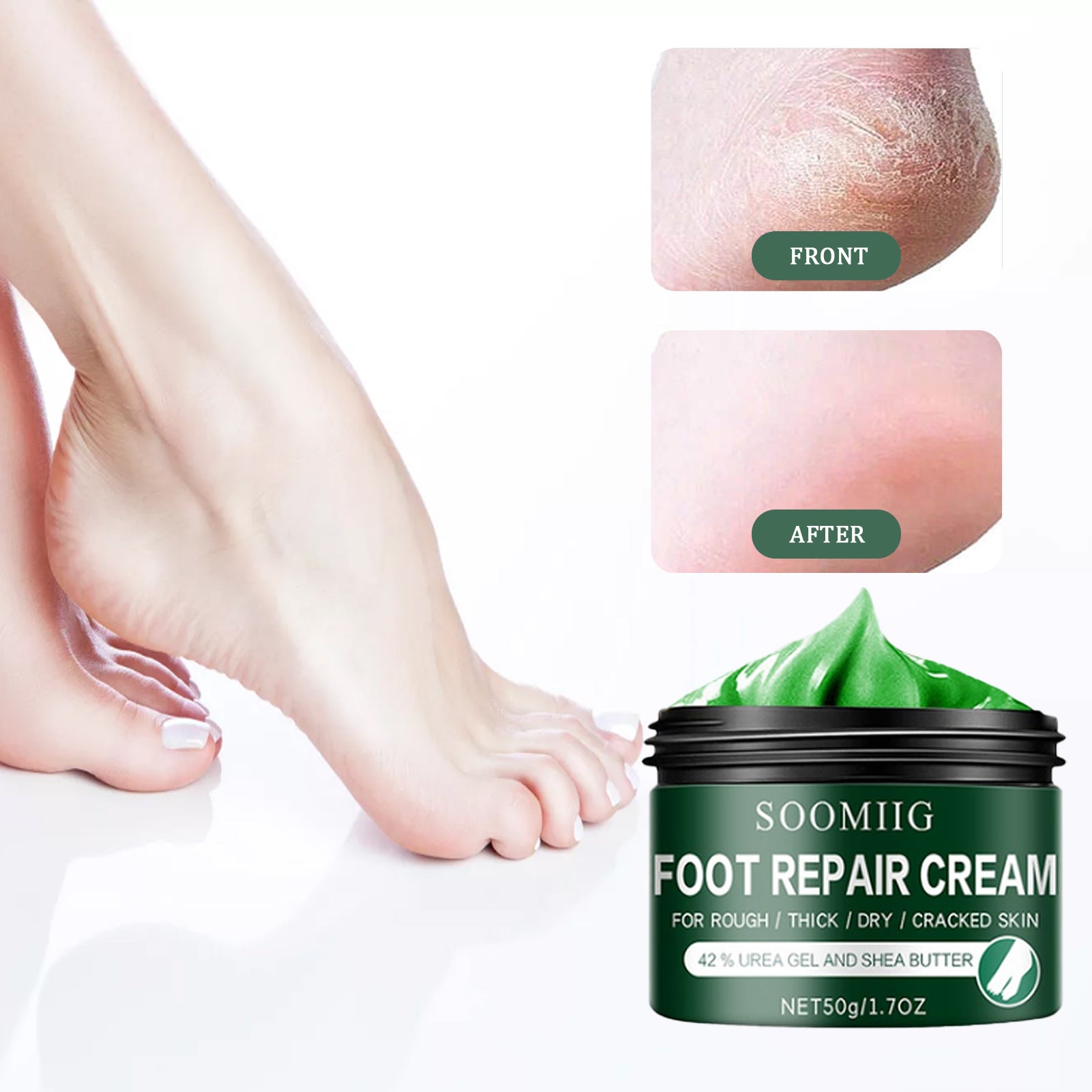 Ultra-Hydrating Foot Cream Therapeutic Foot Moisturizer Soothing Foot Repair Formula Restorative Foot Butter Repairing Dry Feet Cream Repair and Renew Foot Cream