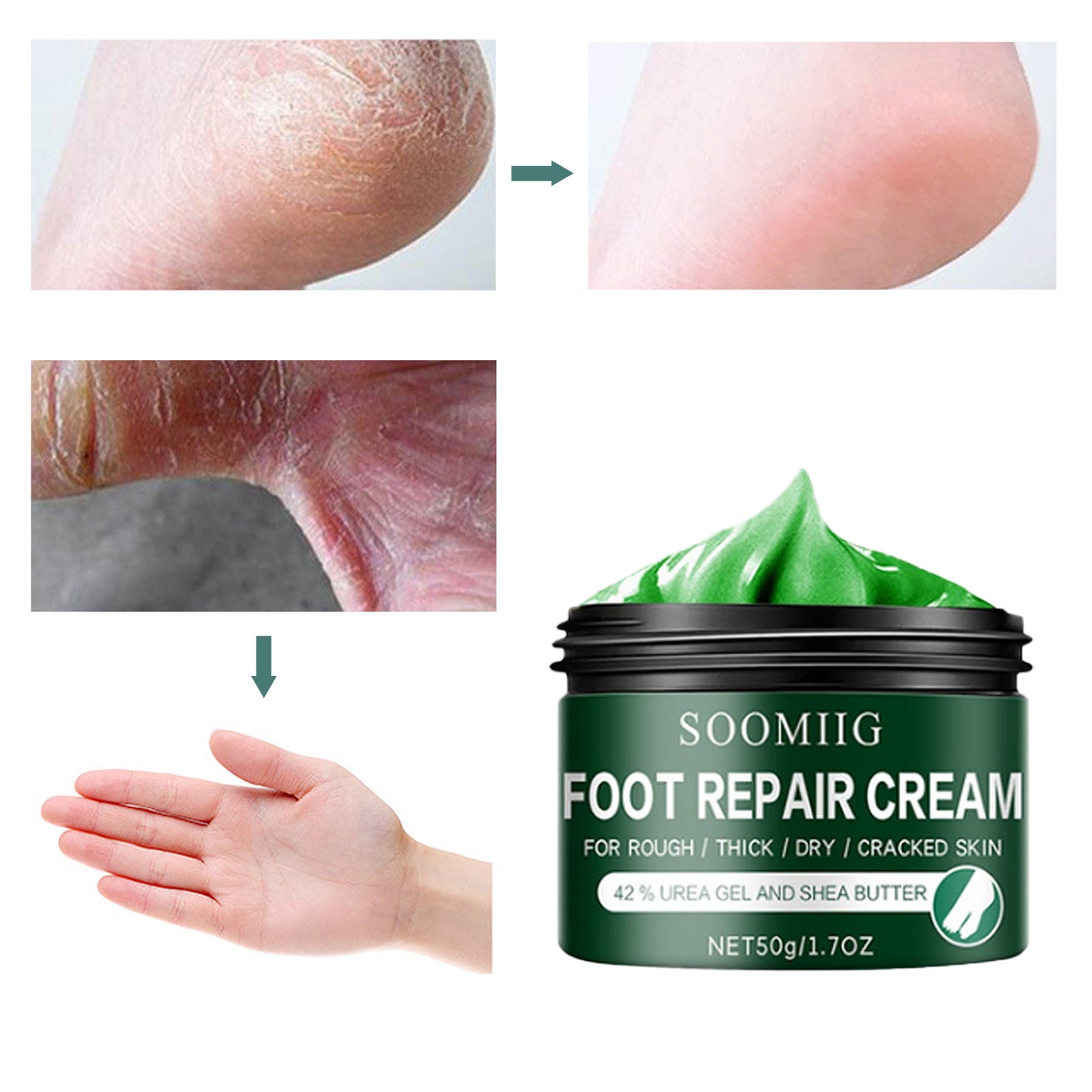 Ultra-Hydrating Foot Cream Therapeutic Foot Moisturizer Soothing Foot Repair Formula Restorative Foot Butter Repairing Dry Feet Cream Repair and Renew Foot Cream